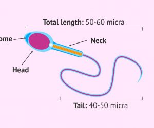 Spermiogramm verstehen: Spermienformen (Morphologie)